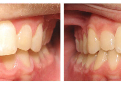 Orthodontics - Before & After